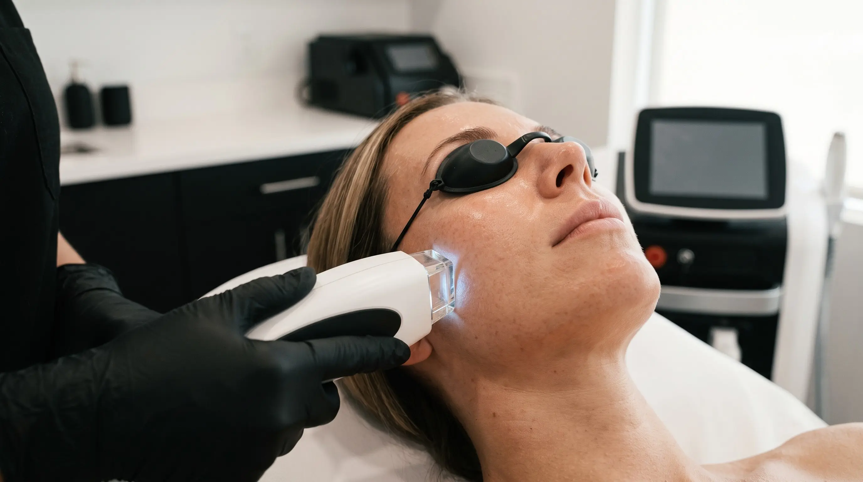 IPL Treatment treatment at SKIN Las Vegas Med Spa in Las Vegas, NV